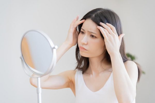 頭皮ニキビの原因と対策を美容師が徹底解説。ニキビを防ぐ頭皮ケアも紹介