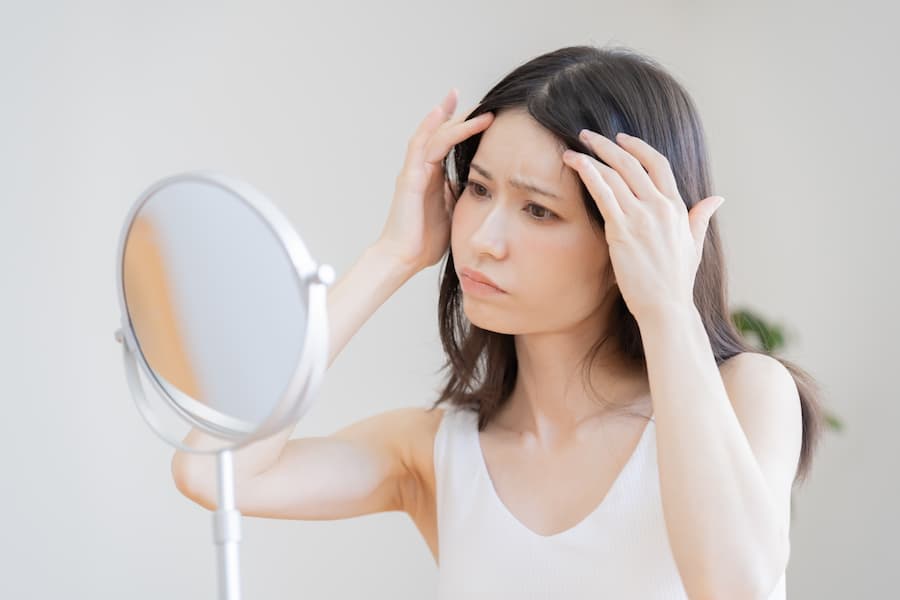 頭皮ニキビの原因と対策を美容師が徹底解説。ニキビを防ぐ頭皮ケアも紹介